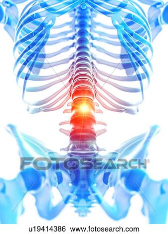 Lumbar pain, conceptual illustration View Large Photo Image Stock Photograph - Lumbar pain, conceptual illustration. Fotosearch