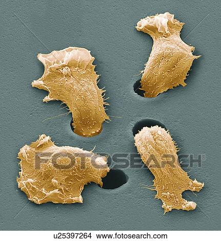 Picture - Migrating sarcoma cancer cells, SEM. Fotosearch