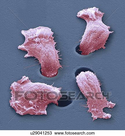 Migrating sarcoma cancer cells, SEM View Large Photo Image Stock Image - Migrating sarcoma cancer cells, SEM. Fotosearch