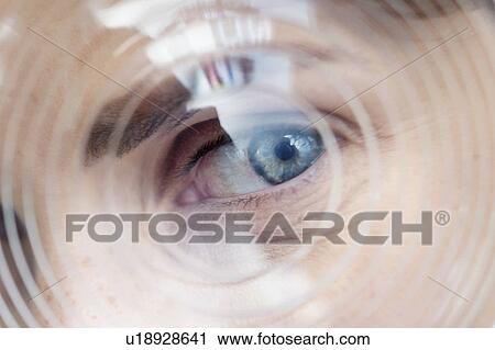 Stock Image - Model ophthalmic lens. Fotosearch