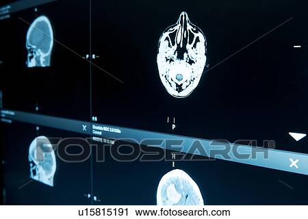Stock Image - MRI brain scans. Fotosearch