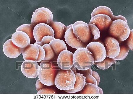 MRSA bacteria, SEM View Large Photo Image Stock Image - MRSA bacteria, SEM. Fotosearch