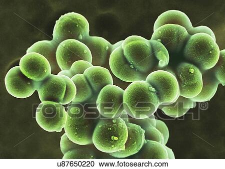 Stock Image - MRSA bacteria, SEM. Fotosearch