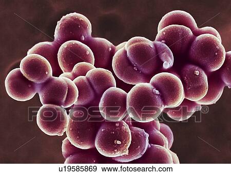 Stock Photo - MRSA bacteria, SEM. Fotosearch