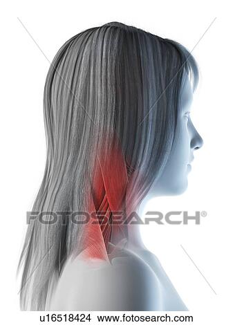Neck muscles, illustration View Large Photo Image Picture - Neck muscles, illustration. Fotosearch