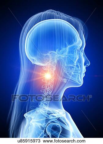 Neck pain, conceptual illustration View Large Photo Image Stock Image - Neck pain, conceptual illustration. Fotosearch