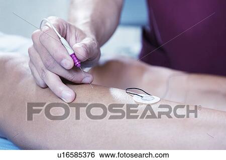 Stock Photograph - Patient undergoing electromyography. Fotosearch