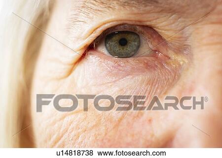 Stock Photo - Senior woman's eye. Fotosearch