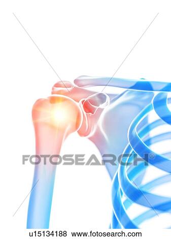 Shoulder pain, conceptual illustration View Large Photo Image Stock Photo - Shoulder pain, conceptual illustration. Fotosearch