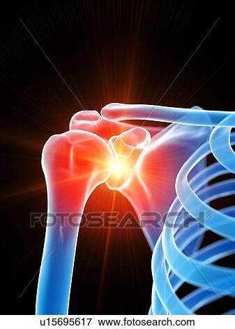 Shoulder pain, conceptual illustration View Large Photo Image Stock Photo - Shoulder pain, conceptual illustration. Fotosearch