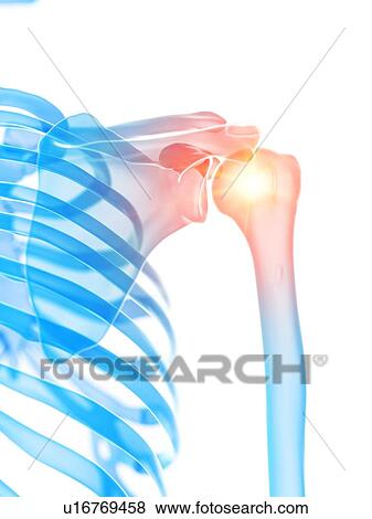 Shoulder pain, conceptual illustration View Large Photo Image Stock Photo - Shoulder pain, conceptual illustration. Fotosearch