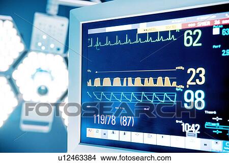 Picture - Surgical light and monitor in operating theatre. Fotosearch