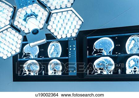 Surgical light and monitors in operating theatre View Large Photo Image Picture - Surgical light and monitors in operating theatre. Fotosearch