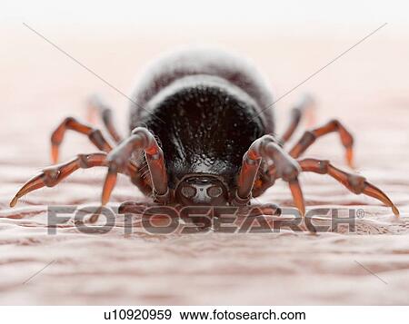 Stock Photo - Tick feeding on a human, illustration. Fotosearch