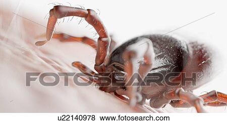 Tick feeding on a human, illustration View Large Photo Image Stock Photo - Tick feeding on a human, illustration. Fotosearch