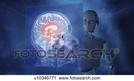 Stock Image - AI powered CT scan analysis, illustration. Fotosearch