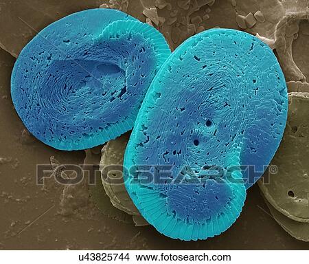Picture - Coccoliths, SEM. Fotosearch