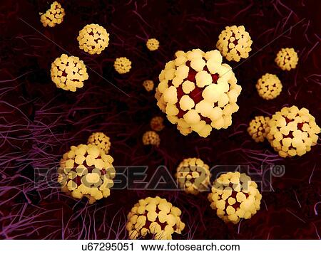 Coronavirus lung infection, illustration View Large Photo Image Stock Image - Coronavirus lung infection, illustration. Fotosearch