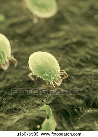 Dust mites, illustration View Large Photo Image Stock Image - Dust mites, illustration. Fotosearch