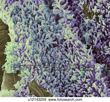 Stock Photo - E. coli bacteria, SEM. Fotosearch