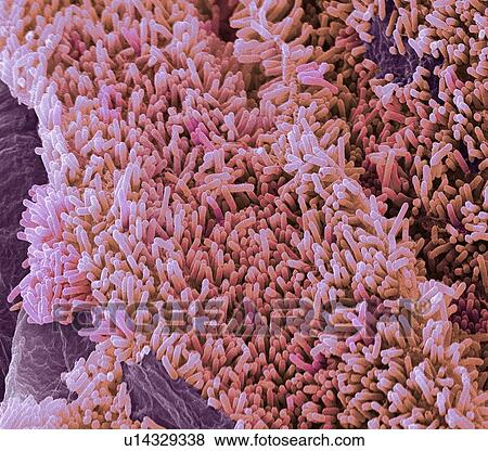 Stock Photo - E. coli bacteria, SEM. Fotosearch