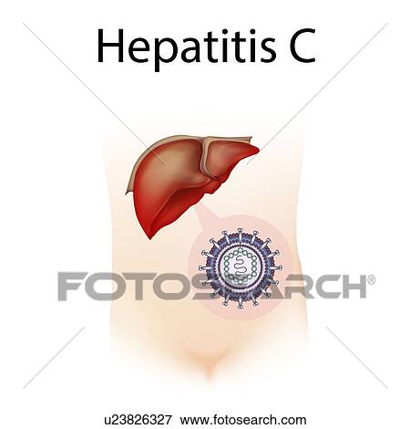 Hepatitis C, illustration View Large Photo Image Stock Photo - Hepatitis C, illustration. Fotosearch