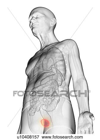 Stock Photo - Illustration of an elderly man's bladder. Fotosearch