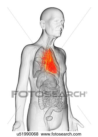 Stock Photo - Illustration of an elderly man's heart. Fotosearch
