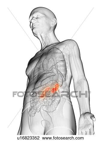 Stock Image - Illustration of an elderly man's kidney. Fotosearch