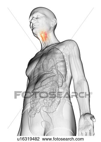 Stock Image - Illustration of an elderly man's larynx. Fotosearch