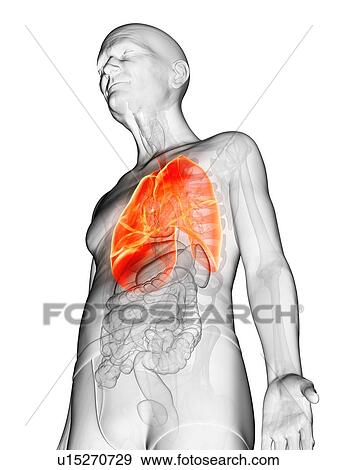 Illustration of an elderly man's lung View Large Photo Image Stock Photo - Illustration of an elderly man's lung. Fotosearch