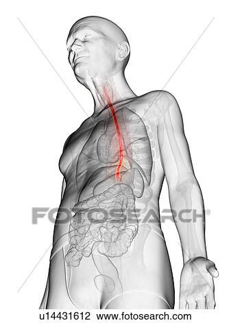 Stock Image - Illustration of an elderly man's esophagus. Fotosearch