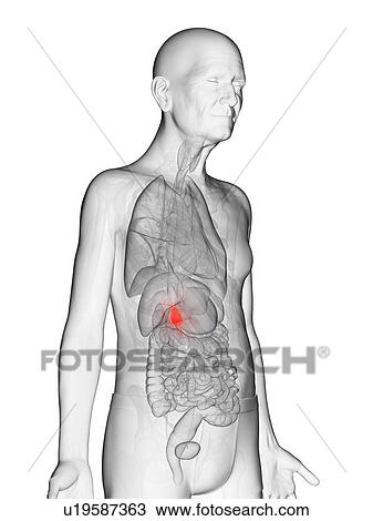 Illustration of an elderly man's gallbladder View Large Photo Image Stock Image - Illustration of an elderly man's gallbladder. Fotosearch