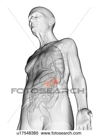 Illustration of an elderly man's adrenal glands View Large Photo Image Stock Photography - Illustration of an elderly man's adrenal glands. Fotosearch