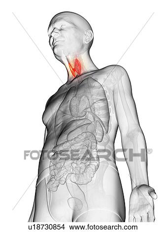Picture - Illustration of an elderly man's thyroid. Fotosearch