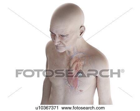 Illustration of an old man with a pace maker View Large Photo Image Stock Image - Illustration of an old man with a pace maker. Fotosearch