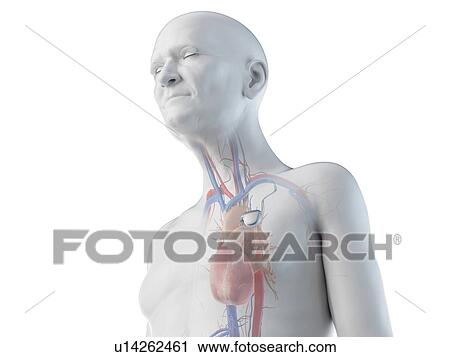 Stock Image - Illustration of an old man with a pace maker. Fotosearch