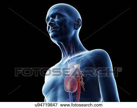 Illustration of an old man with a pace maker View Large Photo Image Stock Photo - Illustration of an old man with a pace maker. Fotosearch