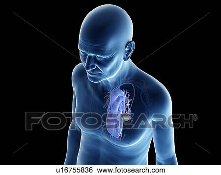 Illustration of an old man with a pace maker View Large Photo Image Stock Photograph - Illustration of an old man with a pace maker. Fotosearch
