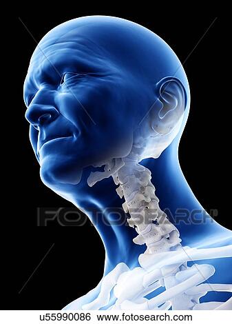 Stock Photograph - Illustration of an old man's cervical spine. Fotosearch