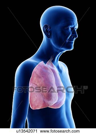 Stock Image - Illustration of an old man's lungs. Fotosearch