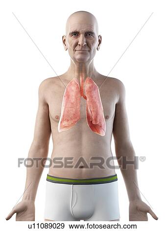 Stock Photo - Illustration of an old man's lungs. Fotosearch