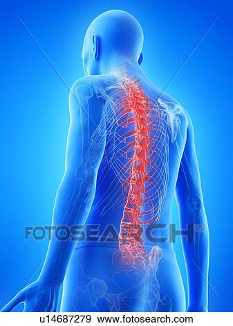 Stock Photo - Illustration of an old man's painful back. Fotosearch