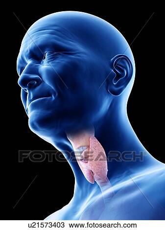 Stock Image - Illustration of an old man's thyroid. Fotosearch