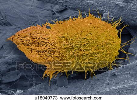Stock Image - Loxophyllum ciliate protozoa, SEM. Fotosearch