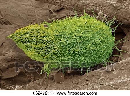 Stock Photo - Loxophyllum ciliate protozoa, SEM. Fotosearch