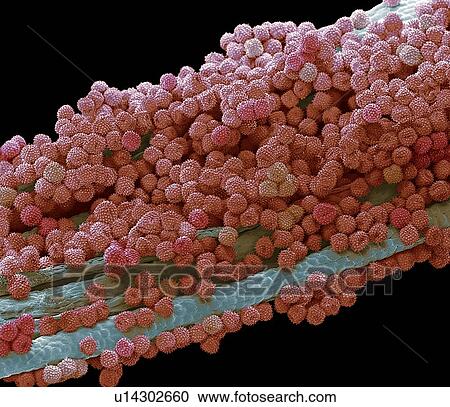 Stock Image - Marigold pollen, SEM. Fotosearch