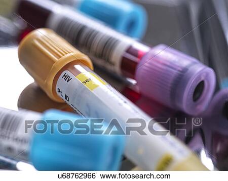 Sample for HIV testing View Large Photo Image Stock Photograph - Sample for HIV testing. Fotosearch