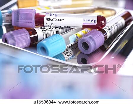 Samples for medical screening View Large Photo Image Picture - Samples for medical screening. Fotosearch