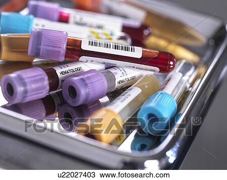 Samples for medical screening View Large Photo Image Stock Image - Samples for medical screening. Fotosearch